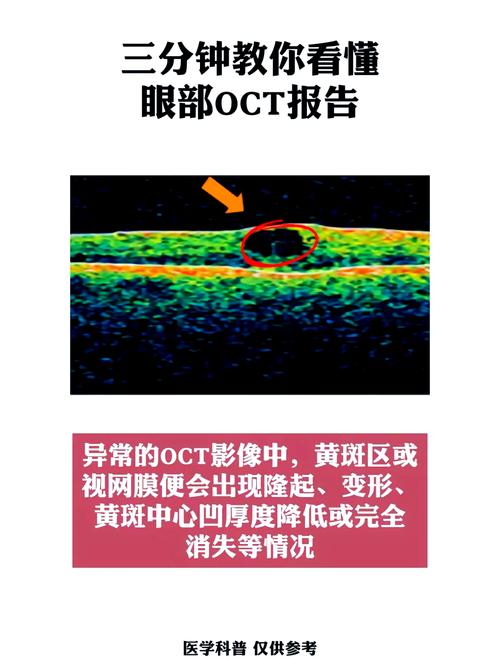 出入境通行证上面日期写的oct是几月份