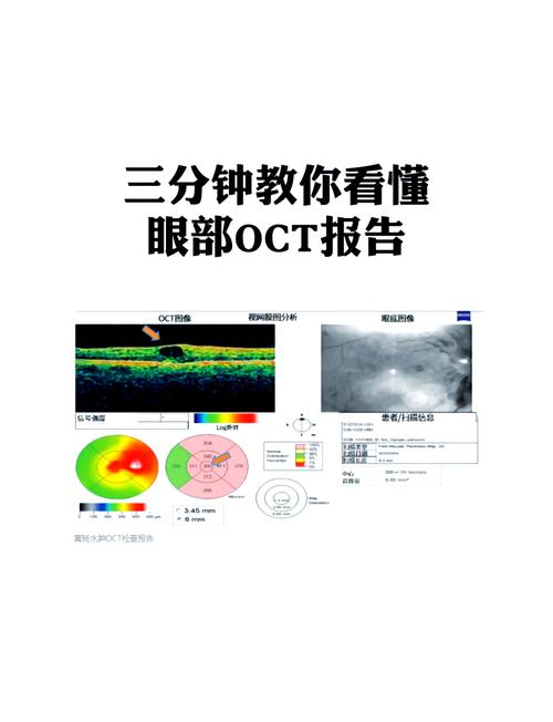 oct是什么意思是几月
